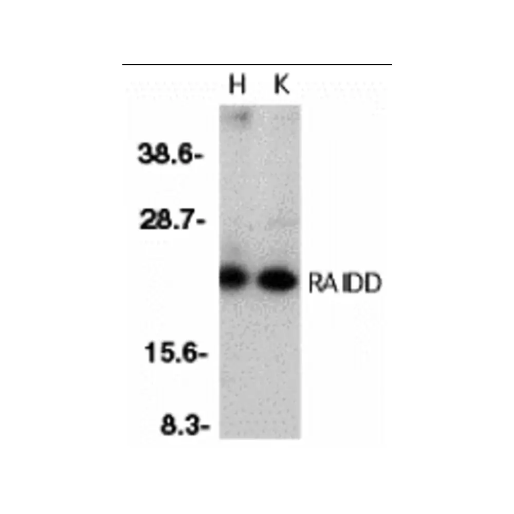ProSci 1115 RAIDD Antibody, ProSci, 0.1 mg/Unit Primary Image