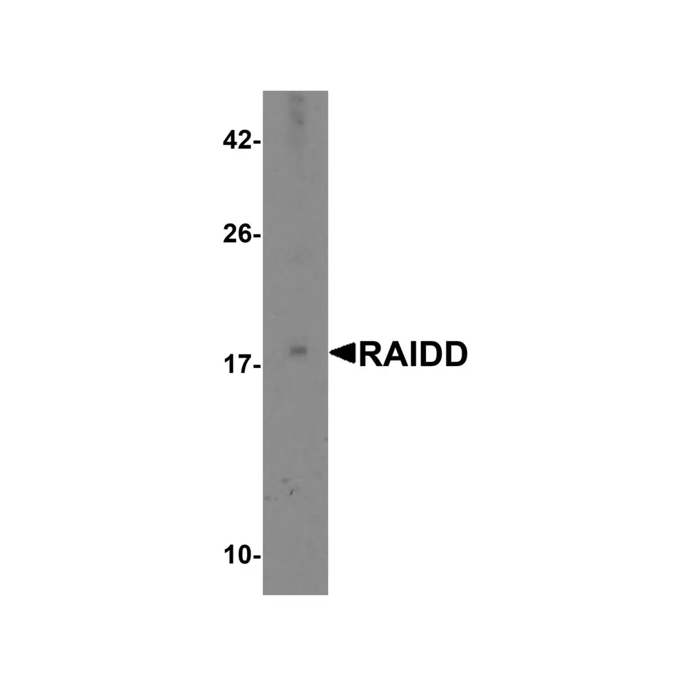 ProSci 1117_S RAIDD Antibody, ProSci, 0.02 mg/Unit Primary Image