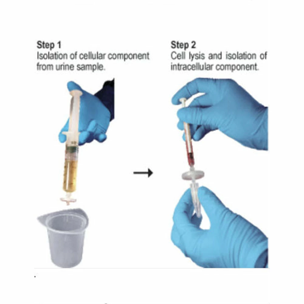 Zymo Research R1038 ZR Urine RNA Isolation Kit, Zymo Research, 20 Preps/Unit secondary image