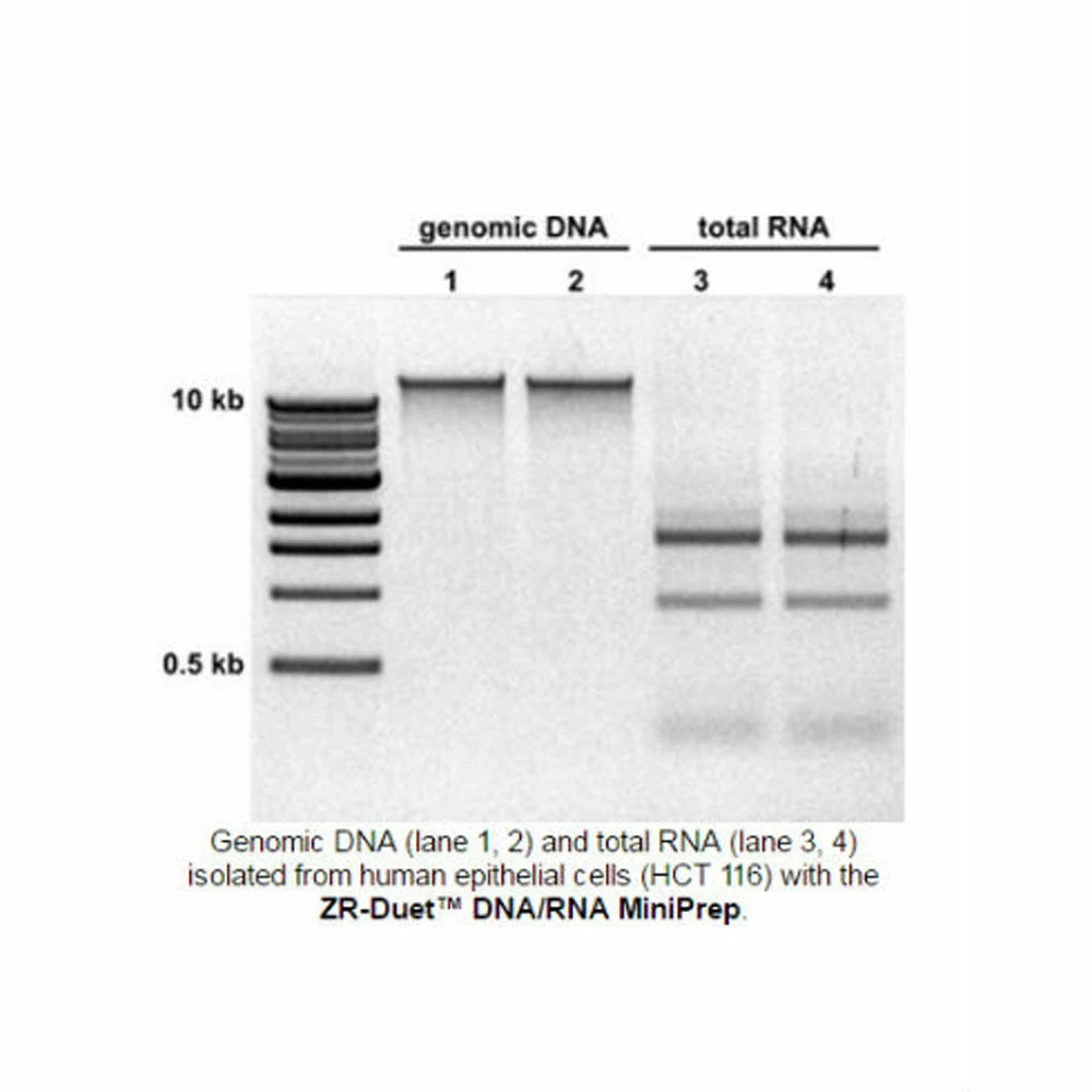 Zymo Research D7003 Quick-DNA/RNA Miniprep Plus Kit, Zymo Research, 50 Preps/Unit secondary image