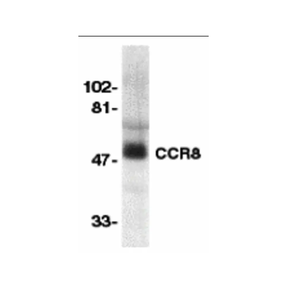 ProSci 2097 CCR8 Antibody, ProSci, 0.1 mg/Unit Primary Image