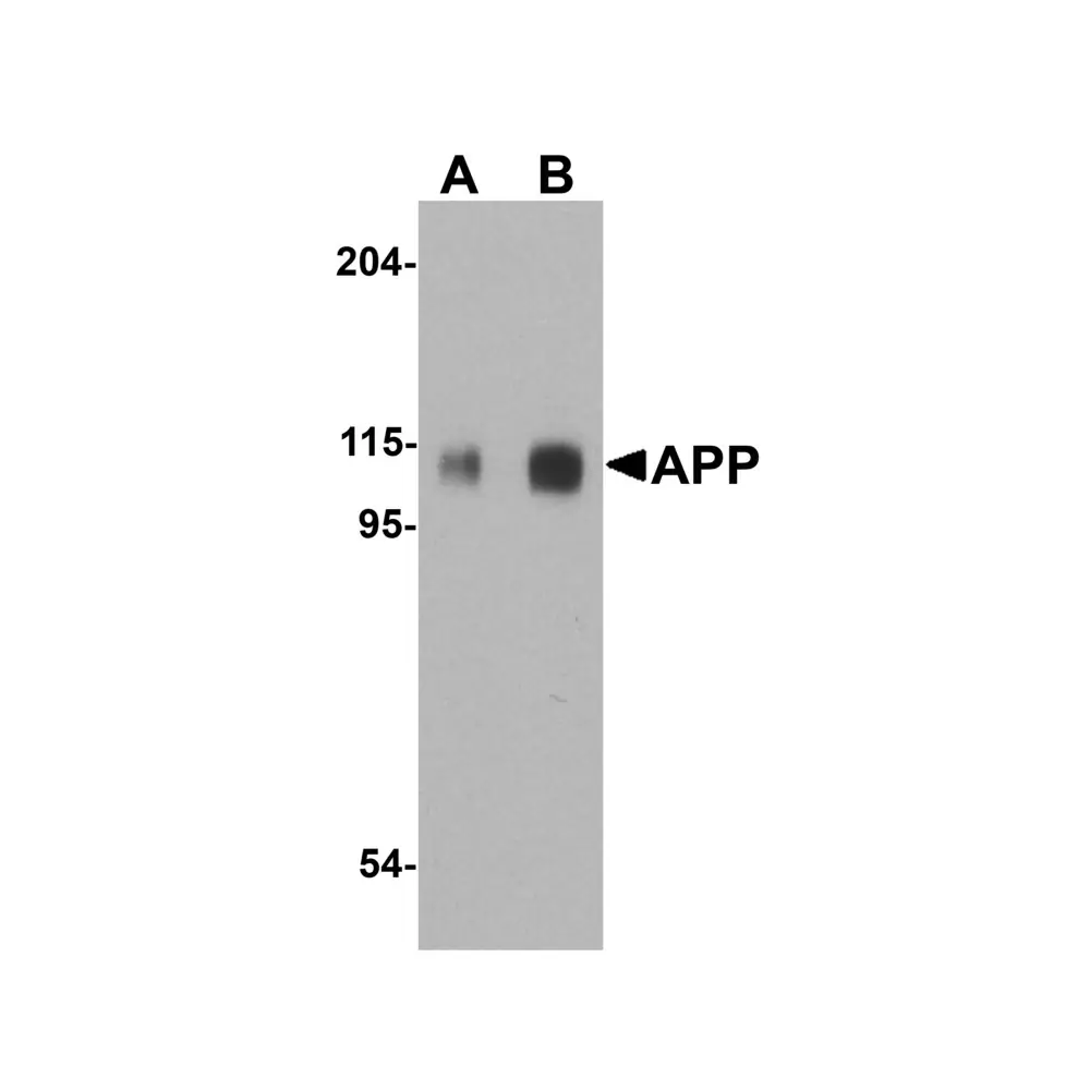 ProSci 2136_S APP Antibody, ProSci, 0.02 mg/Unit Primary Image