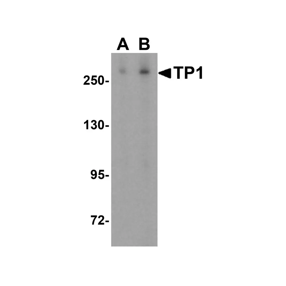 ProSci 2345_S TP1 Antibody, ProSci, 0.02 mg/Unit Primary Image