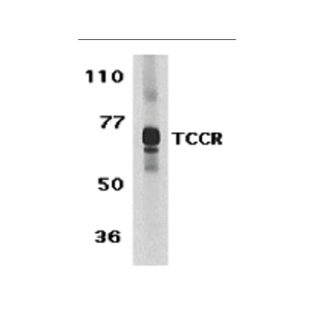 ProSci 2483 TCCR Antibody, ProSci, 0.1 mg/Unit Primary Image