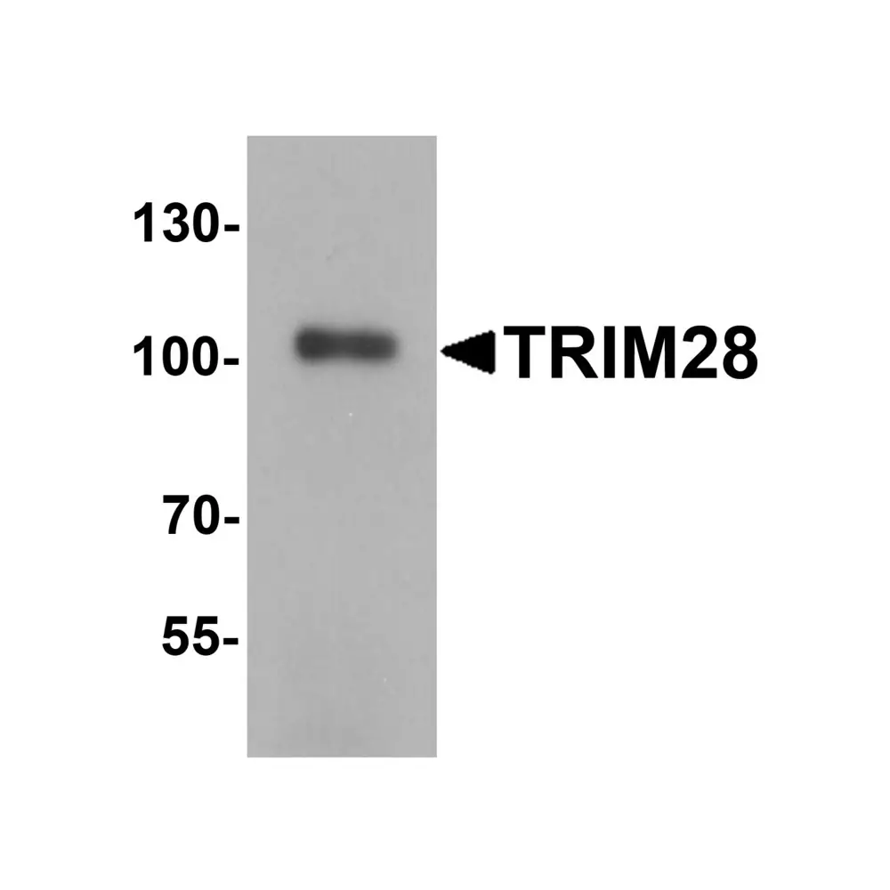 ProSci 2521 TRIM28 Antibody, ProSci, 0.1 mg/Unit Primary Image