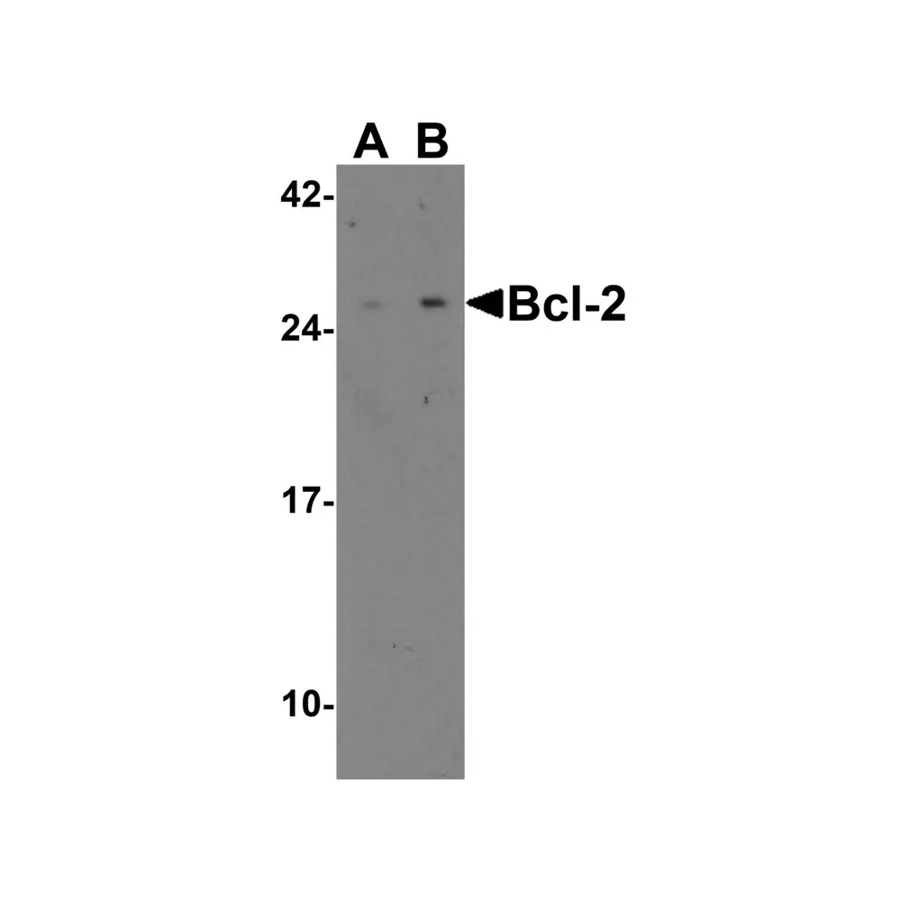 ProSci 3335_S Bcl-2 Antibody, ProSci, 0.02 mg/Unit Primary Image