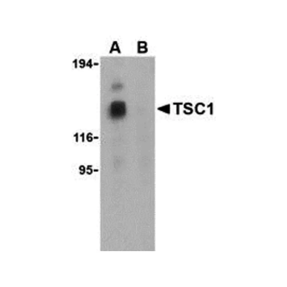 ProSci 3505_S TSC1 Antibody, ProSci, 0.02 mg/Unit Primary Image
