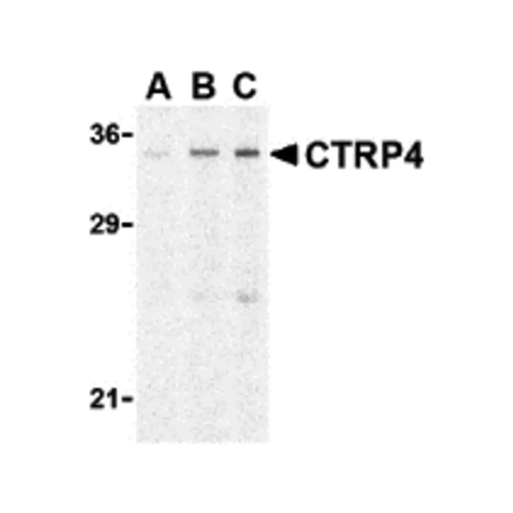 ProSci 3569_S CTRP4 Antibody, ProSci, 0.02 mg/Unit Primary Image
