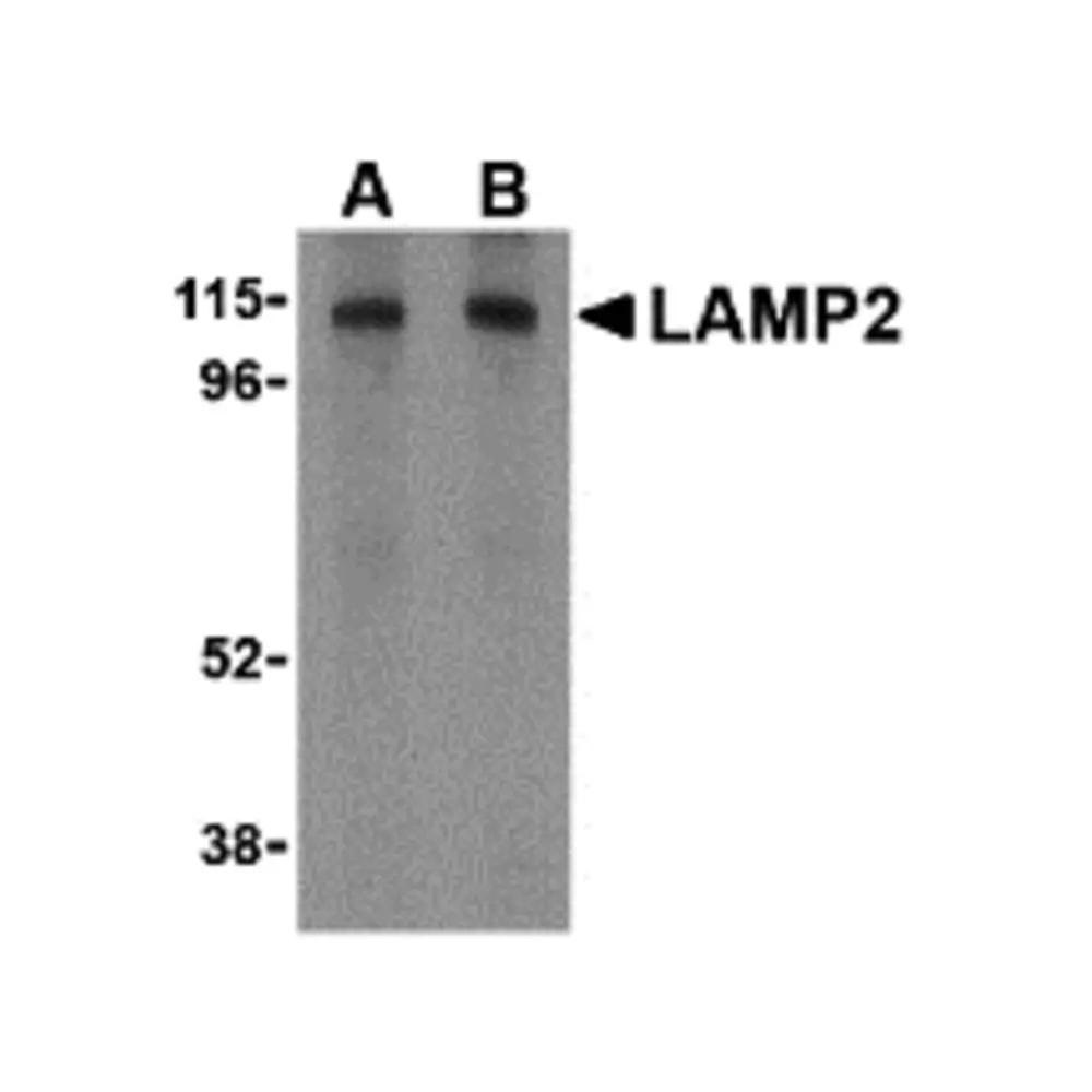 ProSci 3627_S LAMP-2 Antibody, ProSci, 0.02 mg/Unit Primary Image