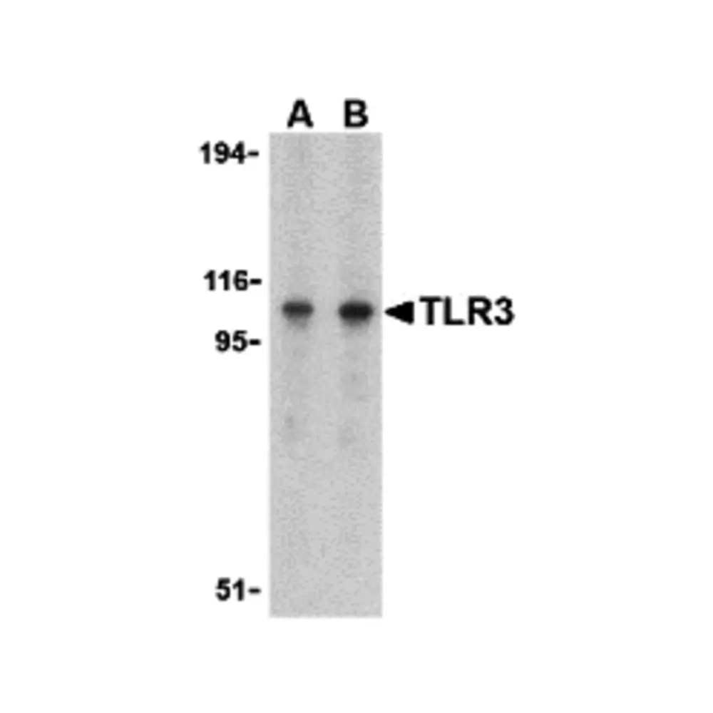 ProSci 3643_S TLR3 Antibody, ProSci, 0.02 mg/Unit Primary Image