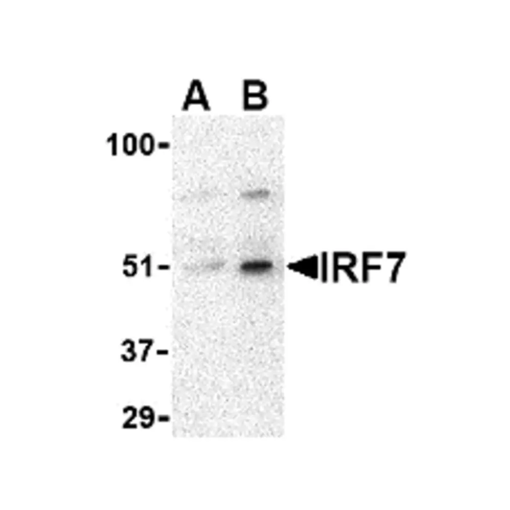 ProSci 3943_S IRF7 Antibody, ProSci, 0.02 mg/Unit Primary Image