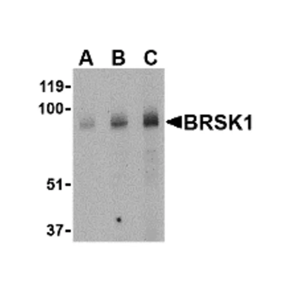 ProSci 4083_S BRSK1 Antibody, ProSci, 0.02 mg/Unit Primary Image
