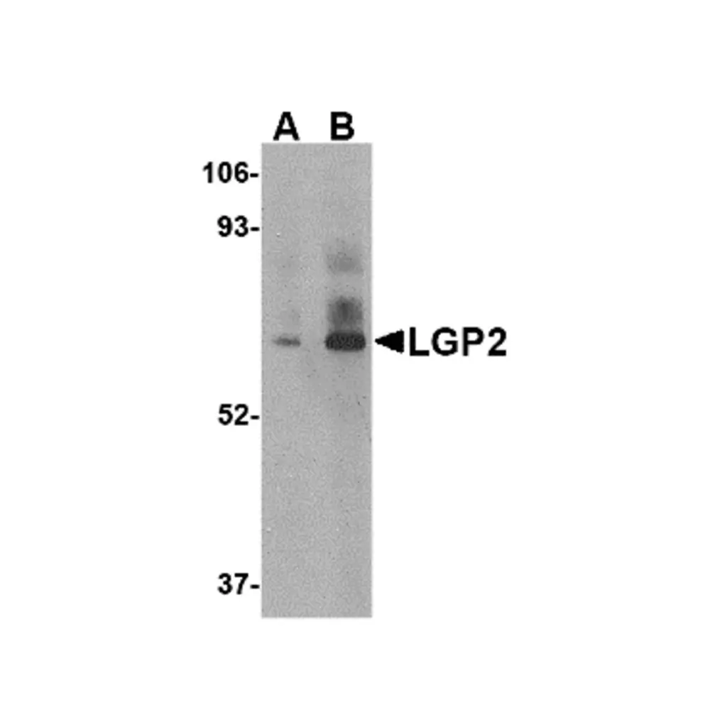ProSci 4351_S LGP2 Antibody, ProSci, 0.02 mg/Unit Primary Image