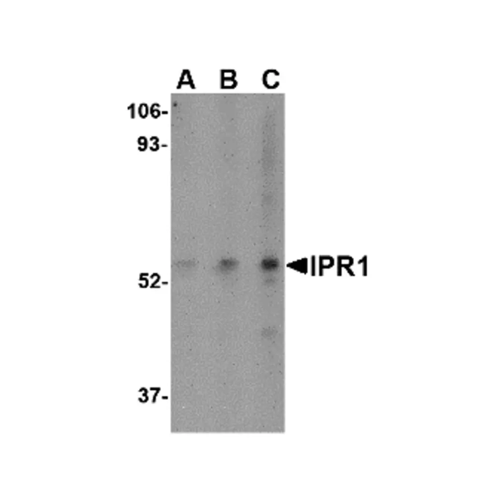 ProSci 4407 IPR1 Antibody, ProSci, 0.1 mg/Unit Primary Image