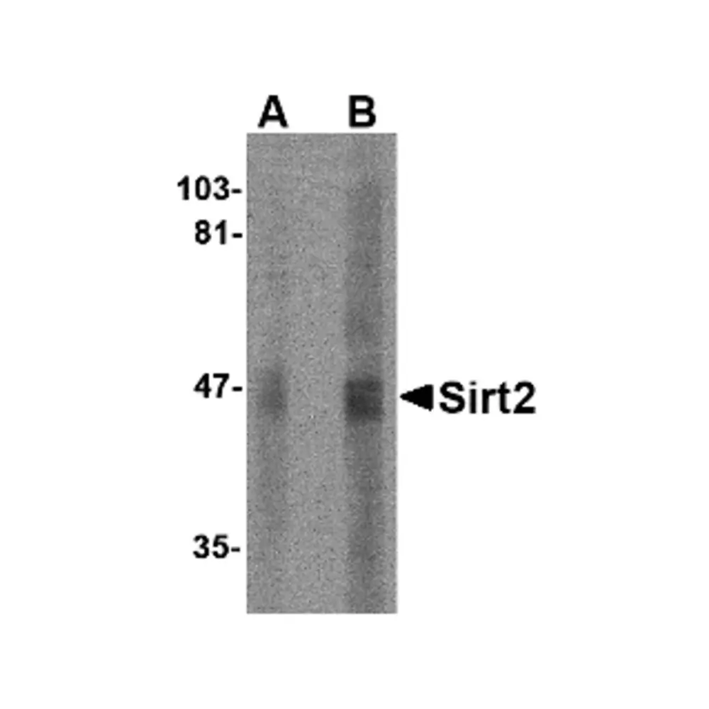 ProSci 4487_S SIRT2 Antibody, ProSci, 0.02 mg/Unit Primary Image