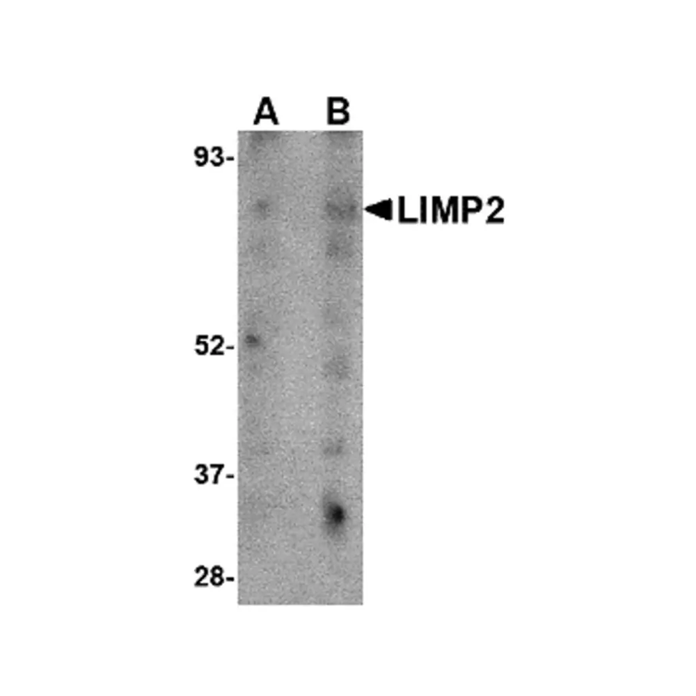 ProSci 4655 LIMP2 Antibody, ProSci, 0.1 mg/Unit Primary Image