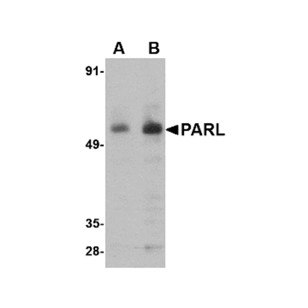 ProSci 4761 PARL Antibody, ProSci, 0.1 mg/Unit Primary Image