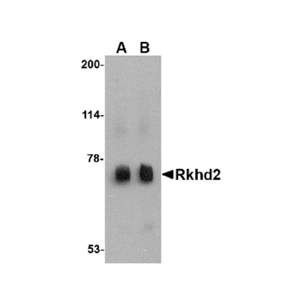 ProSci 4857_S Rkhd2 Antibody, ProSci, 0.02 mg/Unit Primary Image