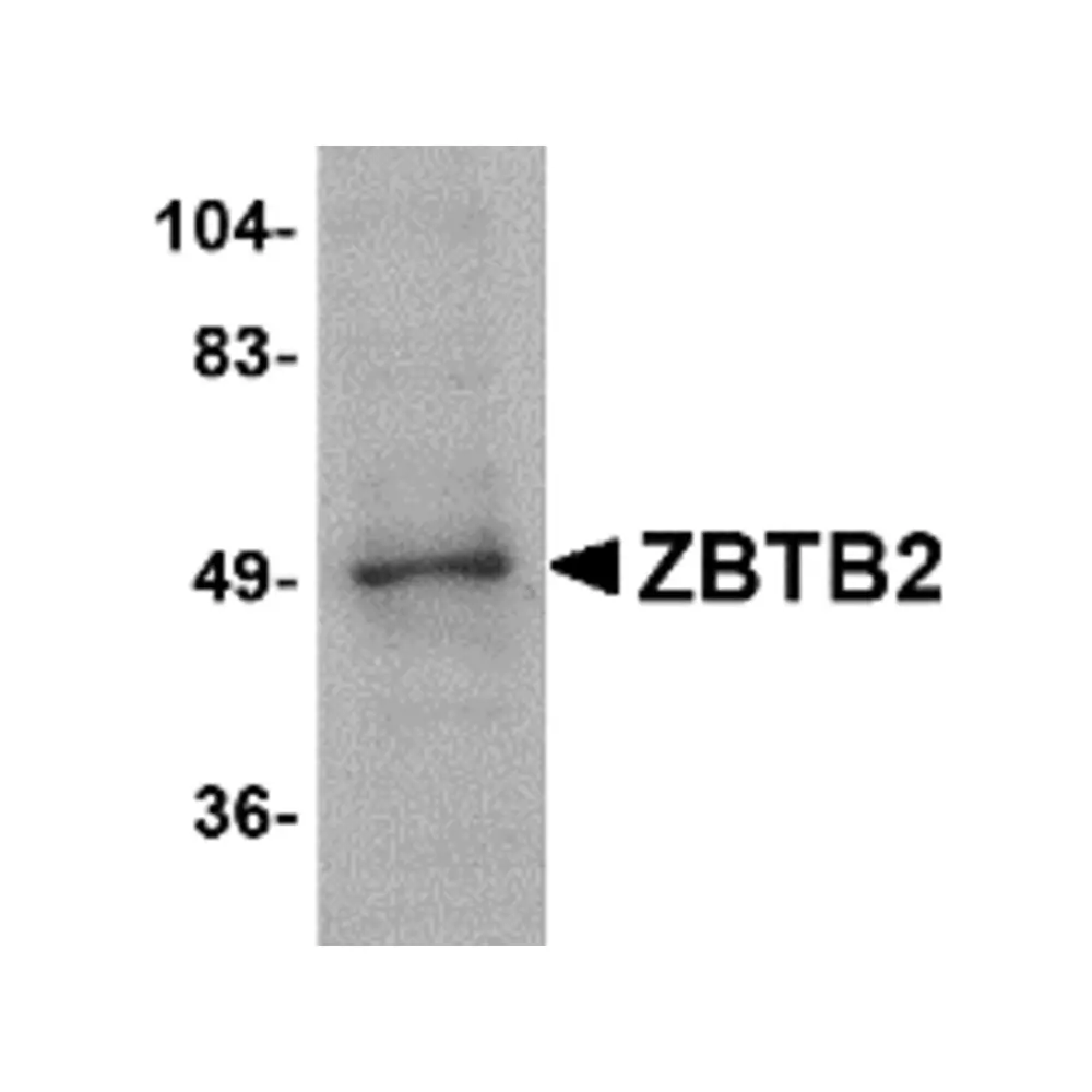 ProSci 4961 ZBTB2 Antibody, ProSci, 0.1 mg/Unit Primary Image