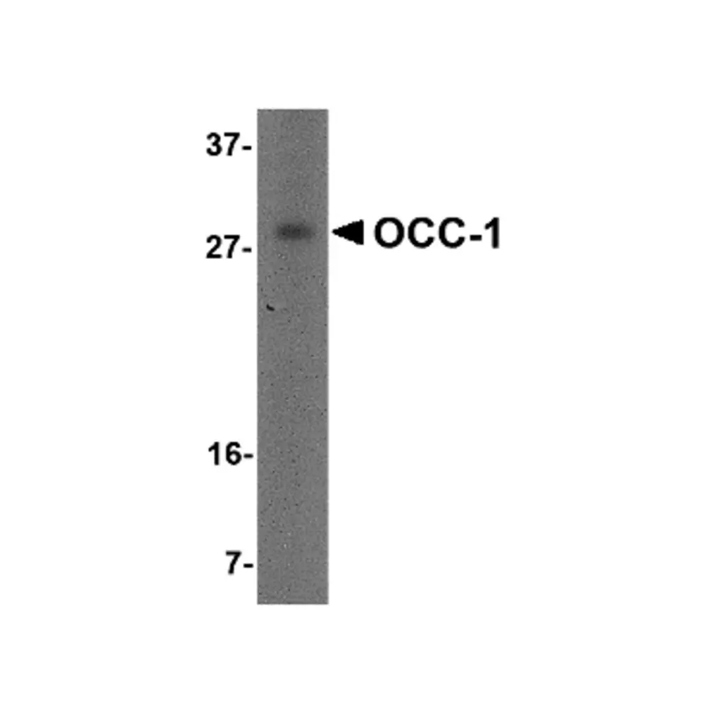 ProSci 4997_S OCC-1 Antibody, ProSci, 0.02 mg/Unit Primary Image