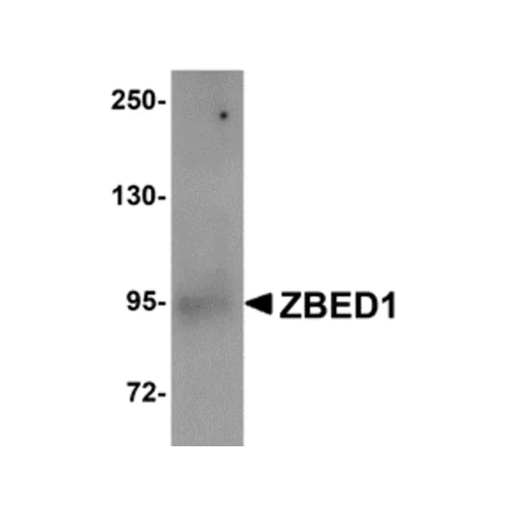 ProSci 5111 ZBED1 Antibody, ProSci, 0.1 mg/Unit Primary Image