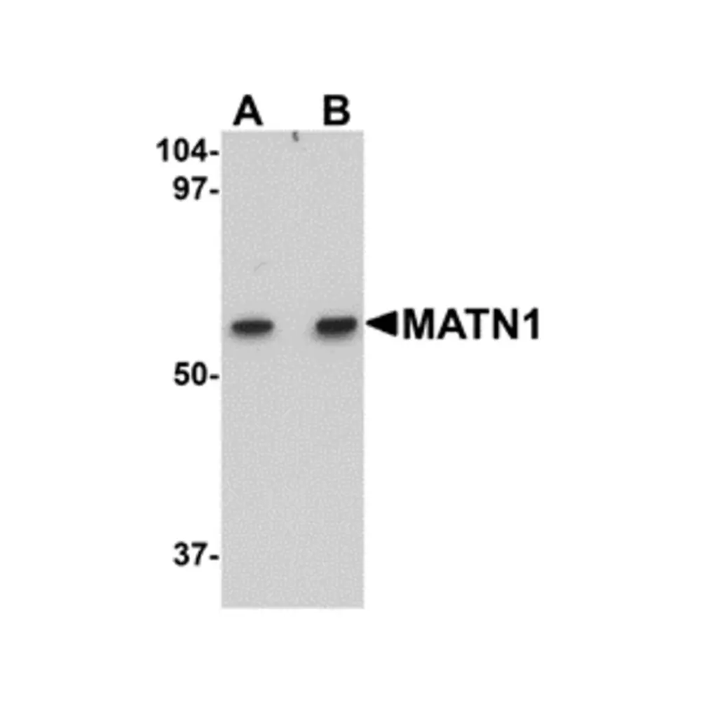 ProSci 5125_S MATN1 Antibody, ProSci, 0.02 mg/Unit Primary Image