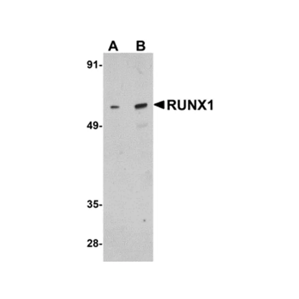 ProSci 5149_S RUNX1 Antibody, ProSci, 0.02 mg/Unit Primary Image