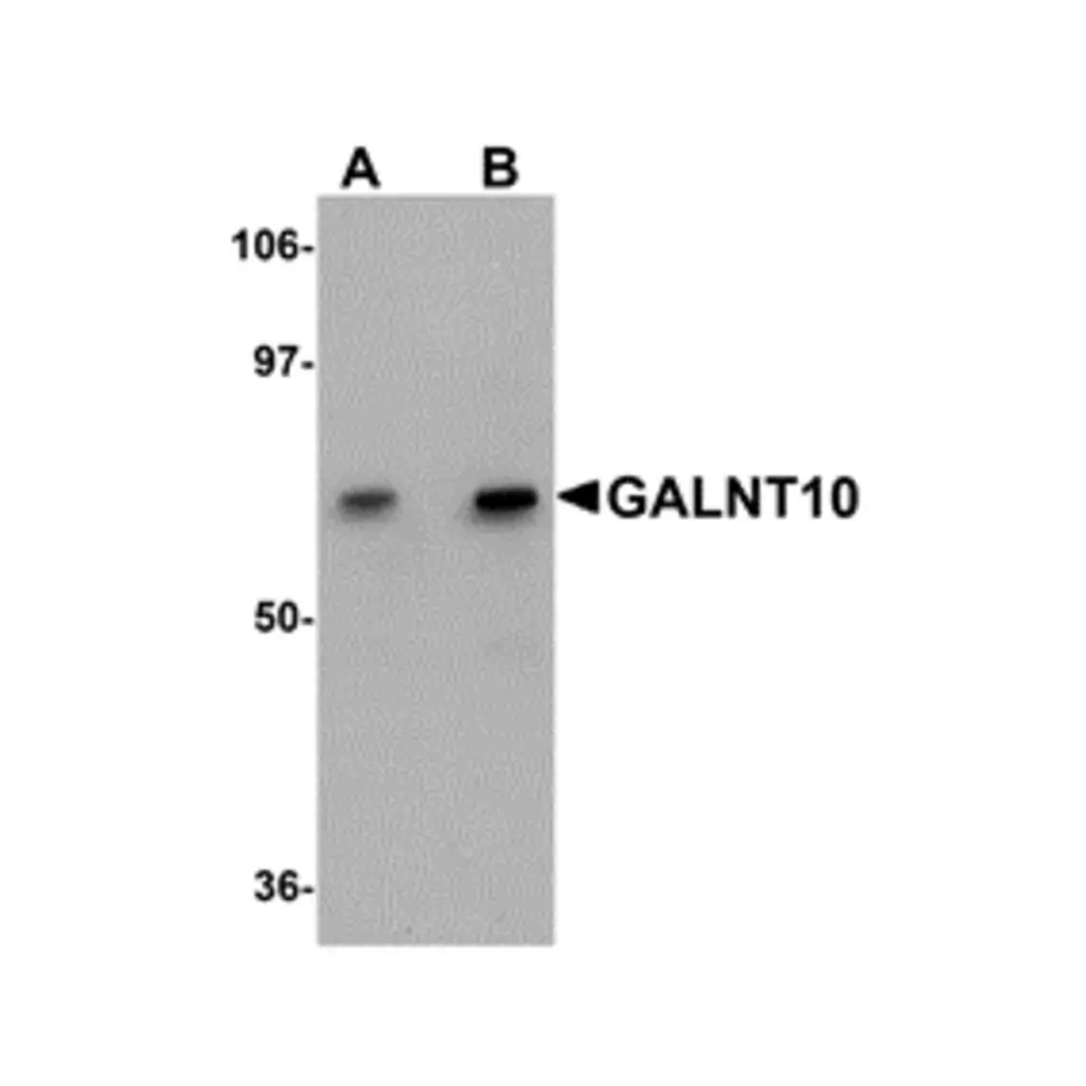 ProSci 5279 GALNT10 Antibody, ProSci, 0.1 mg/Unit Primary Image
