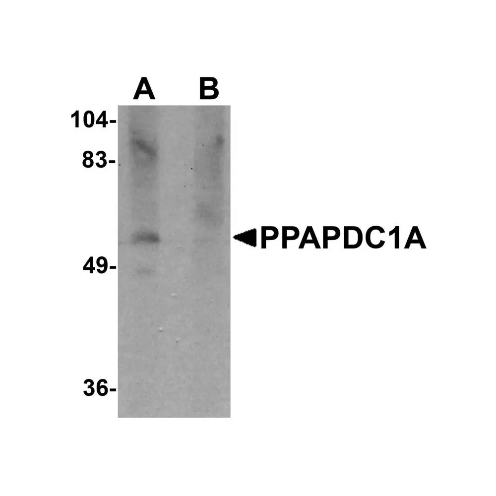 ProSci 5513 PPAPDC1A Antibody, ProSci, 0.1 mg/Unit Primary Image
