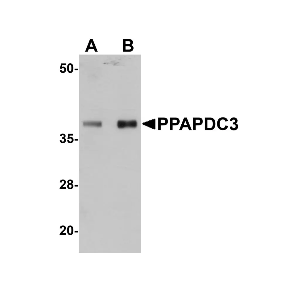 ProSci 5519 PPAPDC3 Antibody, ProSci, 0.1 mg/Unit Primary Image