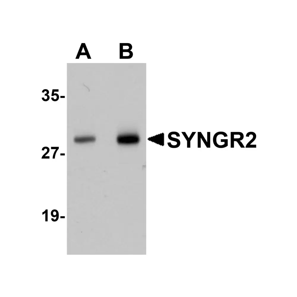 ProSci 5565_S SYNGR2 Antibody, ProSci, 0.02 mg/Unit Primary Image