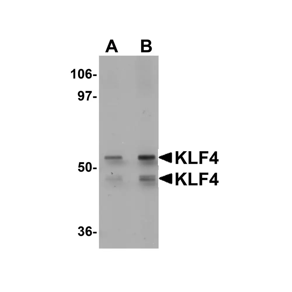 ProSci 5603_S KLF4 Antibody, ProSci, 0.02 mg/Unit Primary Image