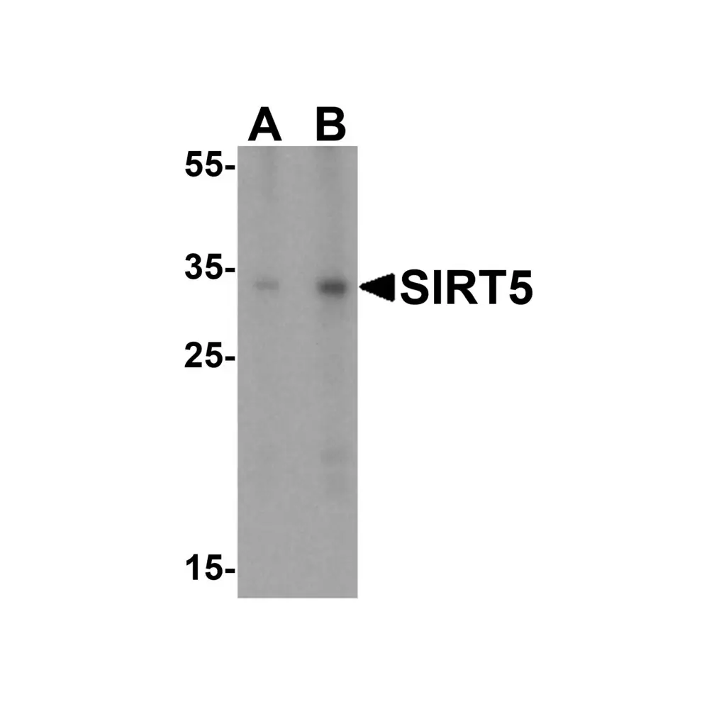 ProSci 5771_S SIRT5 Antibody, ProSci, 0.02 mg/Unit Primary Image