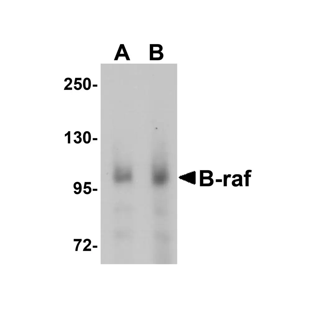 ProSci 5777 B-raf Antibody, ProSci, 0.1 mg/Unit Primary Image