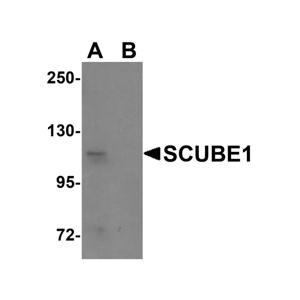 ProSci 5843_S SCUBE1 Antibody, ProSci, 0.02 mg/Unit Primary Image