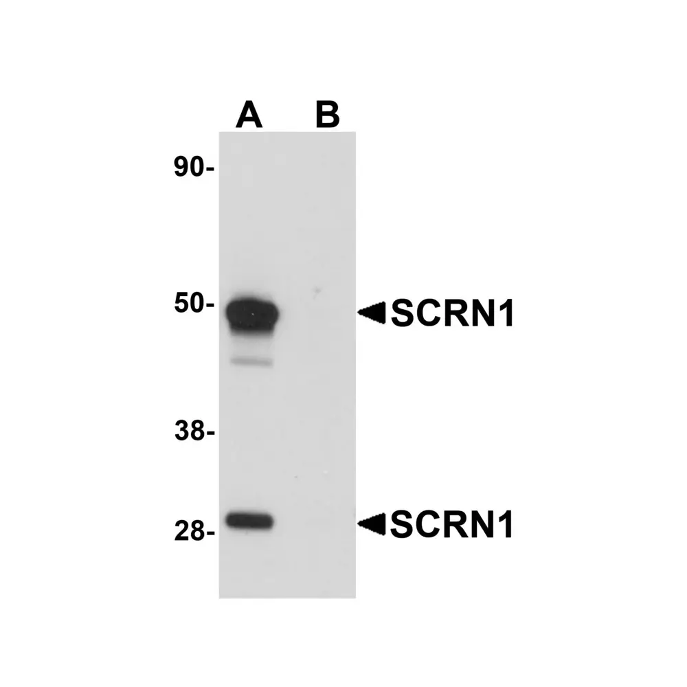 ProSci 5849 SCRN1 Antibody, ProSci, 0.1 mg/Unit Primary Image