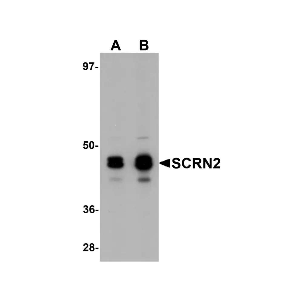ProSci 5851 SCRN2 Antibody, ProSci, 0.1 mg/Unit Primary Image