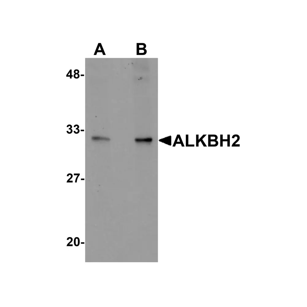 ProSci 5871_S ALKBH2 Antibody, ProSci, 0.02 mg/Unit Primary Image