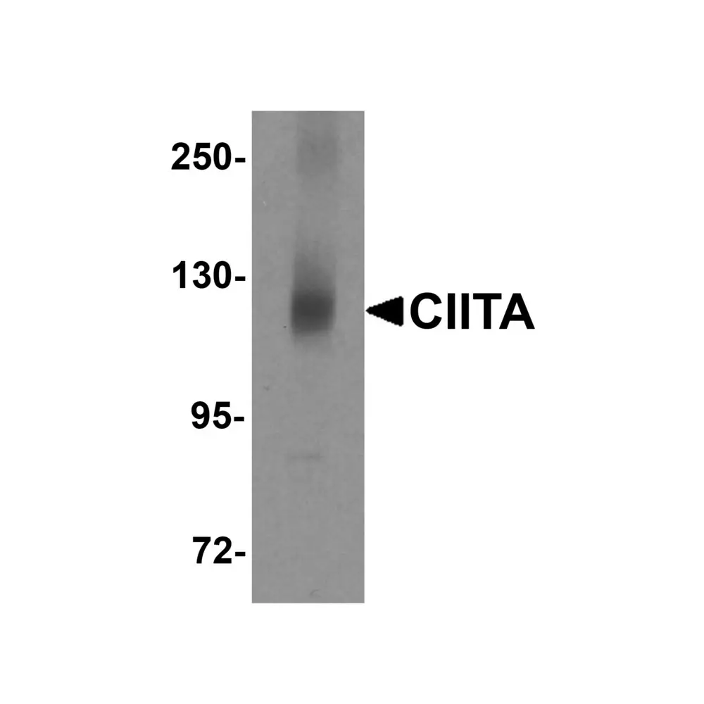 ProSci 5979 CIITA Antibody, ProSci, 0.1 mg/Unit Primary Image