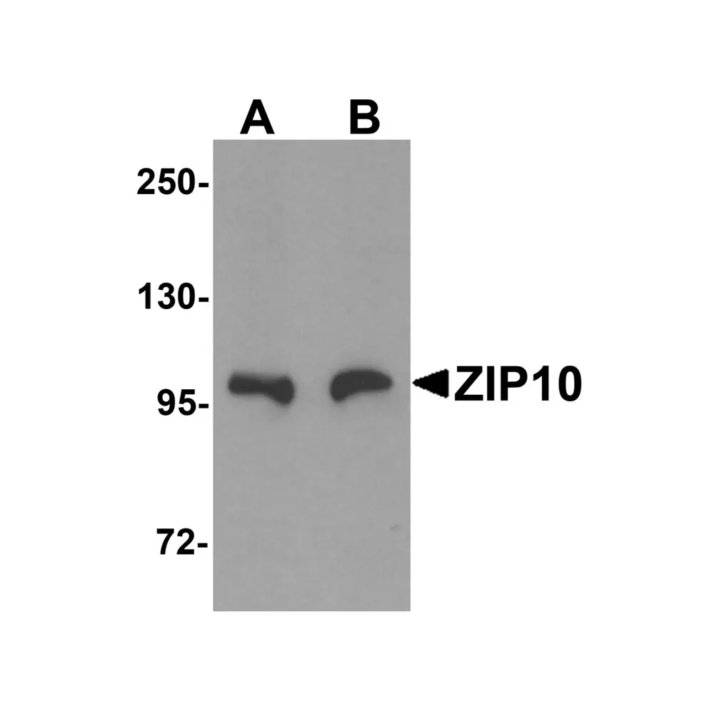 ProSci 6099 ZIP10 Antibody, ProSci, 0.1 mg/Unit Primary Image