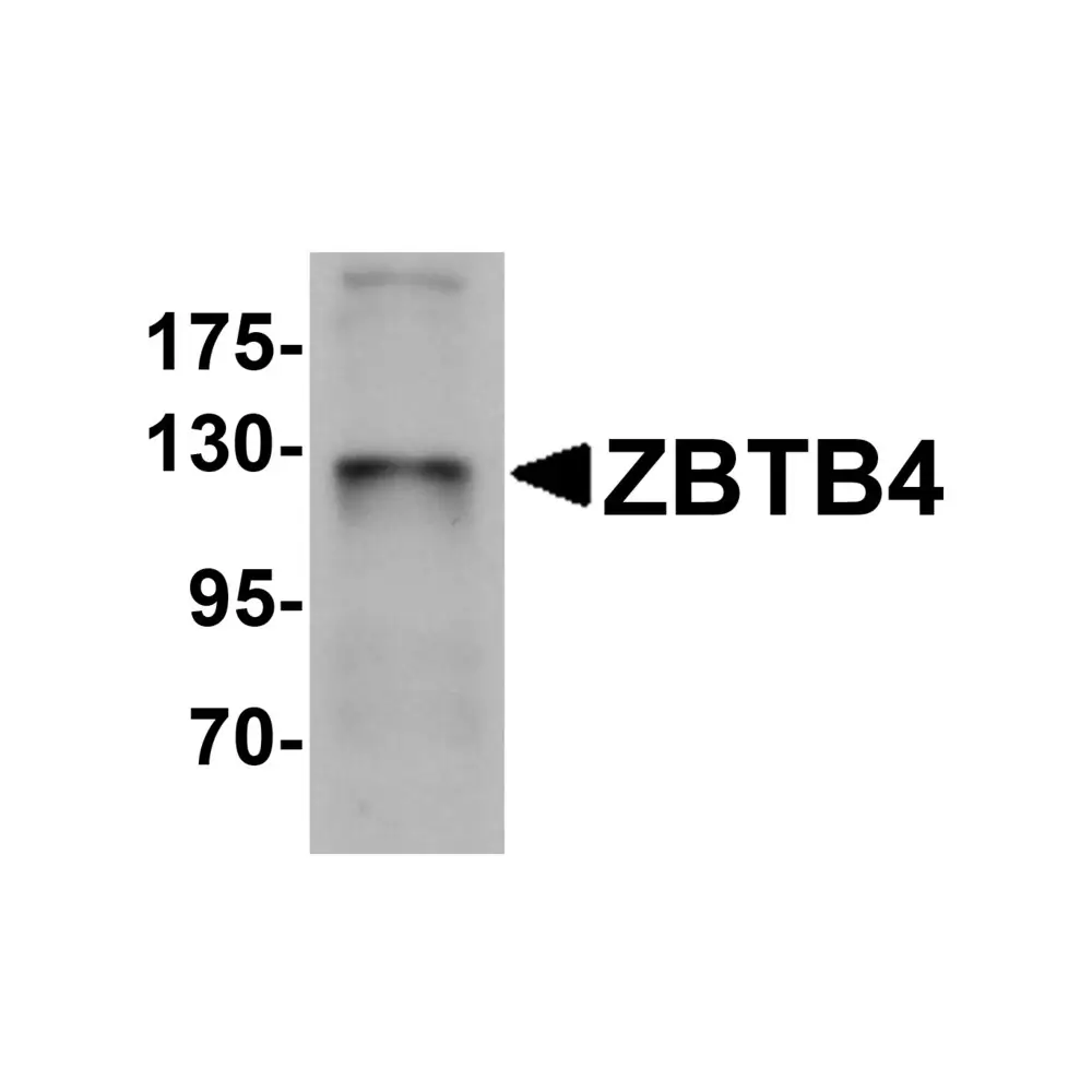 ProSci 6121 ZBTB4 Antibody, ProSci, 0.1 mg/Unit Primary Image