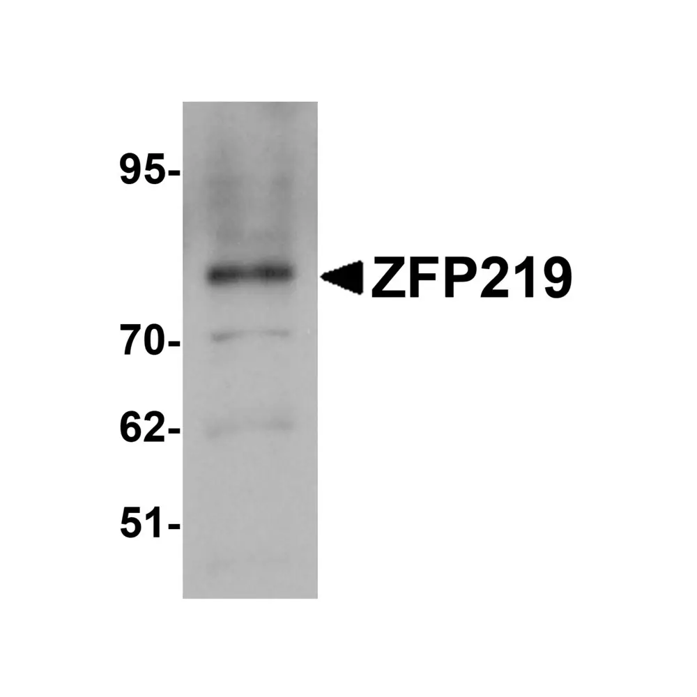 ProSci 6231_S ZFP219 Antibody, ProSci, 0.02 mg/Unit Primary Image