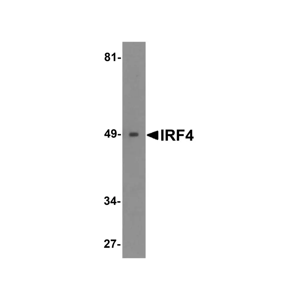 ProSci 6307 IRF4 Antibody, ProSci, 0.1 mg/Unit Primary Image