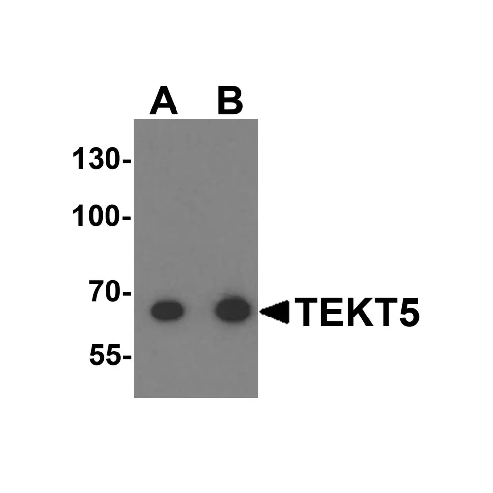 ProSci 6383_S TEKT5 Antibody, ProSci, 0.02 mg/Unit Primary Image