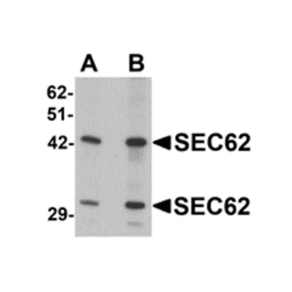 ProSci 6471_S SEC62 Antibody, ProSci, 0.02 mg/Unit Primary Image