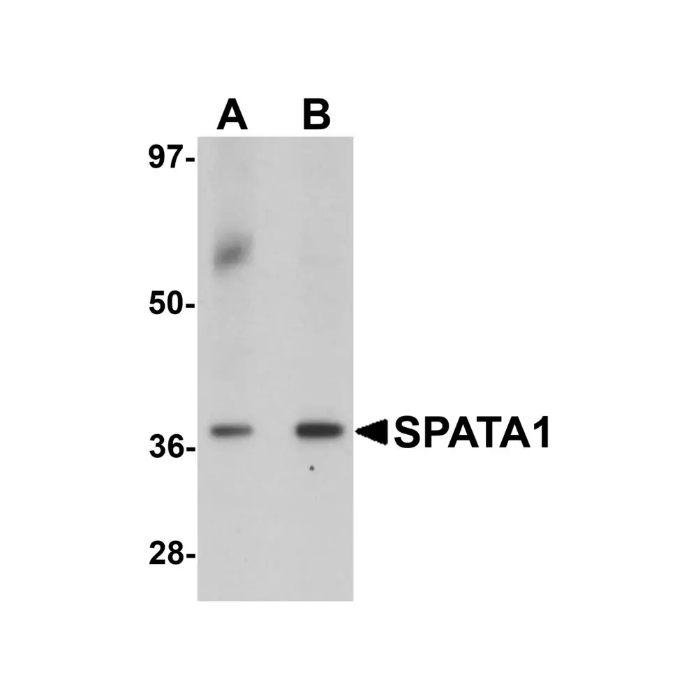 ProSci 6549_S SPATA1 Antibody, ProSci, 0.02 mg/Unit Primary Image