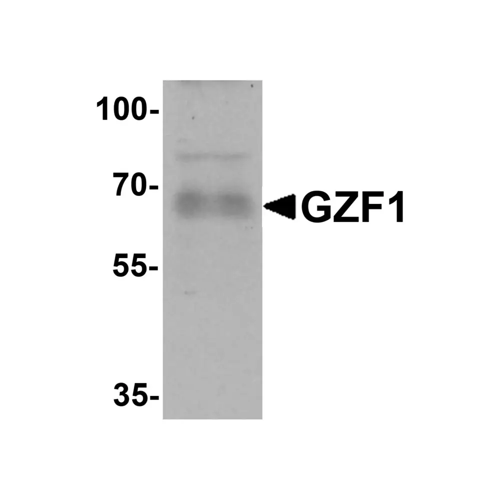 ProSci 6793_S GZF1 Antibody, ProSci, 0.02 mg/Unit Primary Image