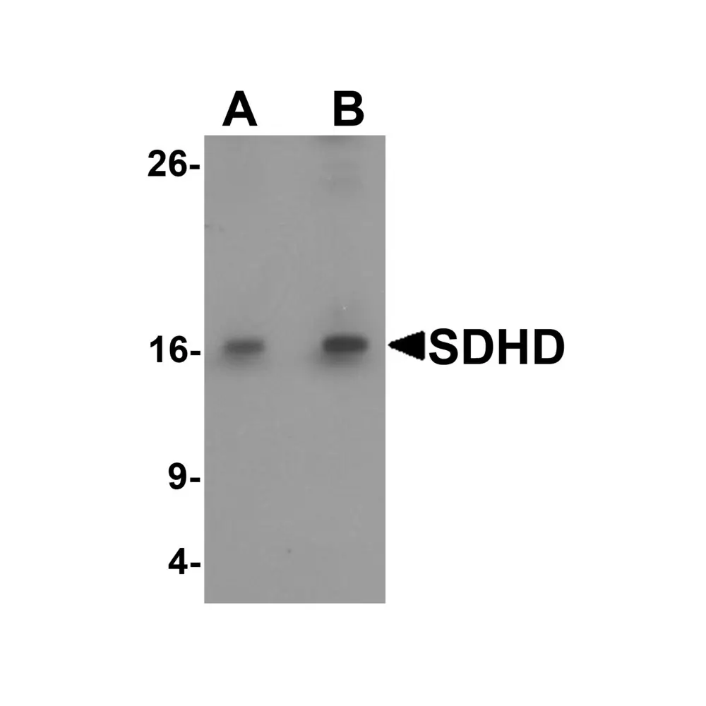 ProSci 6847 SDHD Antibody, ProSci, 0.1 mg/Unit Primary Image