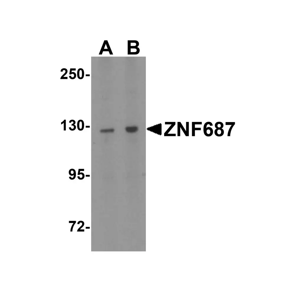 ProSci 6861 ZNF687 Antibody, ProSci, 0.1 mg/Unit Primary Image