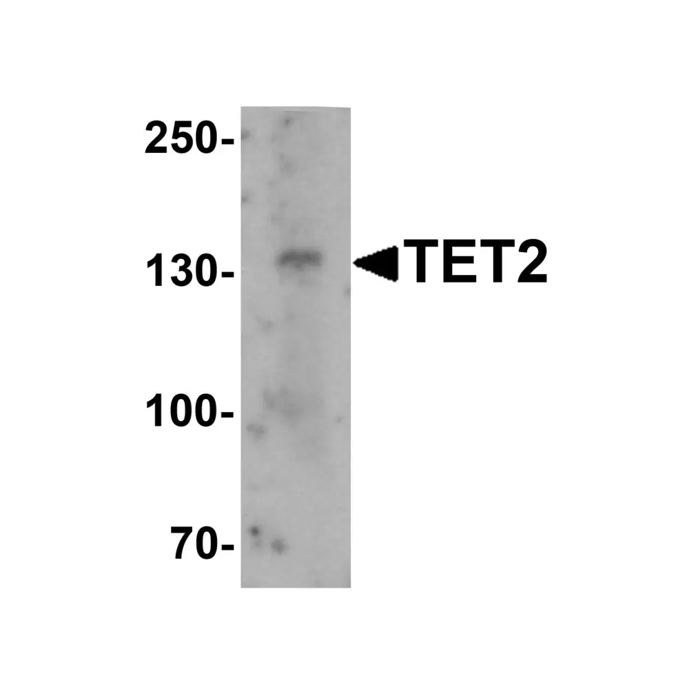ProSci 6915_S TET2 Antibody, ProSci, 0.02 mg/Unit Primary Image